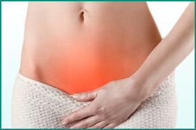 Cystitis in women